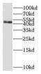 3-Oxoacyl-ACP Synthase, Mitochondrial antibody, FNab06054, FineTest, Western Blot image 