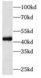 PtdIns(4)P-5-kinase-like protein 1 antibody, FNab06466, FineTest, Western Blot image 