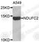 NADH:Ubiquinone Oxidoreductase Subunit C2 antibody, A3312, ABclonal Technology, Western Blot image 