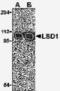 Lysine Demethylase 1A antibody, TA306301, Origene, Western Blot image 