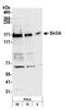 Paired amphipathic helix protein Sin3a antibody, NB100-2253, Novus Biologicals, Western Blot image 