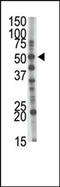 Glucosaminyl (N-Acetyl) Transferase 1 antibody, AP12174PU-N, Origene, Western Blot image 