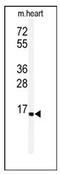 Ubiquitin Conjugating Enzyme E2 G1 antibody, AP11982PU-N, Origene, Western Blot image 