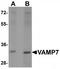 Vesicle-associated membrane protein 7 antibody, TA319712, Origene, Western Blot image 