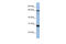 Mediator Complex Subunit 4 antibody, 26-547, ProSci, Western Blot image 