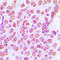 Jun Proto-Oncogene, AP-1 Transcription Factor Subunit antibody, LS-C352430, Lifespan Biosciences, Immunohistochemistry frozen image 