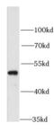 Retinoic Acid Receptor Alpha antibody, FNab07120, FineTest, Western Blot image 