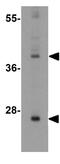 Sirtuin 3 antibody, GTX85105, GeneTex, Western Blot image 