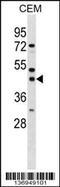 Single Stranded DNA Binding Protein 3 antibody, 58-925, ProSci, Western Blot image 
