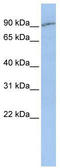 Solute carrier family 15 member 2 antibody, TA333731, Origene, Western Blot image 
