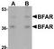 Bifunctional Apoptosis Regulator antibody, TA306918, Origene, Western Blot image 