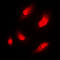 N-alpha-acetyltransferase 15, NatA auxiliary subunit antibody, LS-C353559, Lifespan Biosciences, Immunofluorescence image 