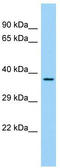 Family With Sequence Similarity 110 Member C antibody, TA332224, Origene, Western Blot image 