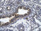 Zinc finger RNA-binding protein antibody, ARP34527_P050, Aviva Systems Biology, Immunohistochemistry paraffin image 