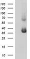 Secretory Carrier Membrane Protein 2 antibody, LS-C338311, Lifespan Biosciences, Western Blot image 