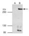 AT-Rich Interaction Domain 1A antibody, GTX129433, GeneTex, Immunoprecipitation image 