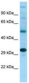 NDRG Family Member 4 antibody, TA338024, Origene, Western Blot image 