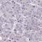 Solute Carrier Family 35 Member E2A antibody, HPA062711, Atlas Antibodies, Immunohistochemistry frozen image 