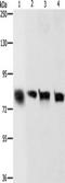 Cadherin 6 antibody, TA349547, Origene, Western Blot image 
