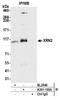 5'-3' Exoribonuclease 2 antibody, A301-103A, Bethyl Labs, Immunoprecipitation image 