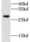 Glutathione S-transferase Mu 1 antibody, FNab03692, FineTest, Western Blot image 