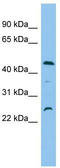Protein OSCP1 antibody, TA337632, Origene, Western Blot image 