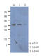 Carboxymethylenebutenolidase Homolog antibody, AM50020PU-S, Origene, Western Blot image 