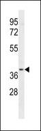 Leukotriene B4 receptor 2 antibody, LS-C163916, Lifespan Biosciences, Western Blot image 