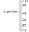 LYN Proto-Oncogene, Src Family Tyrosine Kinase antibody, LS-C291511, Lifespan Biosciences, Western Blot image 