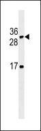 Lymphotoxin Beta antibody, LS-C163914, Lifespan Biosciences, Western Blot image 