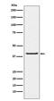 Pro-Apoptotic WT1 Regulator antibody, M03637-1, Boster Biological Technology, Western Blot image 