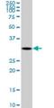 2,4-Dienoyl-CoA Reductase 2 antibody, H00026063-M03, Novus Biologicals, Western Blot image 