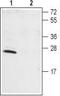 Potassium Voltage-Gated Channel Interacting Protein 1 antibody, TA328986, Origene, Western Blot image 