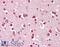 Lactate Dehydrogenase C antibody, 45-826, ProSci, Immunohistochemistry paraffin image 