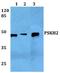 Protein Serine Kinase H2 antibody, A16538, Boster Biological Technology, Western Blot image 