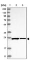 TBC1 Domain Family Member 25 antibody, PA5-56082, Invitrogen Antibodies, Western Blot image 