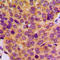 Matrix Metallopeptidase 19 antibody, LS-C352535, Lifespan Biosciences, Immunohistochemistry paraffin image 