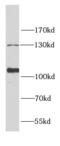 Inositol Polyphosphate-5-Phosphatase J antibody, FNab04330, FineTest, Western Blot image 