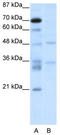 Forkhead Box N2 antibody, TA335850, Origene, Western Blot image 