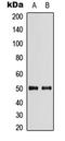 Solute Carrier Family 29 Member 2 antibody, LS-C354348, Lifespan Biosciences, Western Blot image 