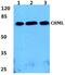 CHM Like Rab Escort Protein antibody, PA5-37038, Invitrogen Antibodies, Western Blot image 