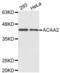 3-ketoacyl-CoA thiolase, mitochondrial antibody, abx004571, Abbexa, Western Blot image 