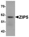 Zinc transporter ZIP5 antibody, orb75534, Biorbyt, Western Blot image 