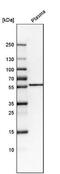 Fukutin Related Protein antibody, NBP2-32543, Novus Biologicals, Western Blot image 