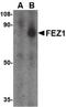 Fasciculation And Elongation Protein Zeta 1 antibody, PA5-20396, Invitrogen Antibodies, Western Blot image 