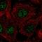 Chromosome 17 Open Reading Frame 50 antibody, HPA043184, Atlas Antibodies, Immunocytochemistry image 