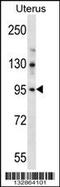Leucine Rich Repeat Containing 37B antibody, 56-909, ProSci, Western Blot image 