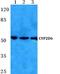 Cytochrome P450 Family 2 Subfamily D Member 6 antibody, GTX66735, GeneTex, Western Blot image 