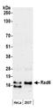 Ubiquitin Conjugating Enzyme E2 A antibody, A300-283A, Bethyl Labs, Western Blot image 