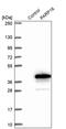 Poly(ADP-Ribose) Polymerase Family Member 16 antibody, PA5-53550, Invitrogen Antibodies, Western Blot image 